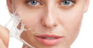 Peeling uygulamaları: Gerekli mi, yoksa zararlı mı?