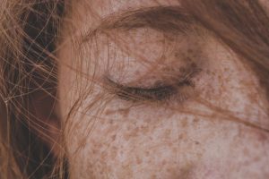 Cilt Mikrobiyomu ve C. acnes: Akneyi Bakteri Çeşitliliği mi Belirliyor? Cilt dokusu yakın çekim