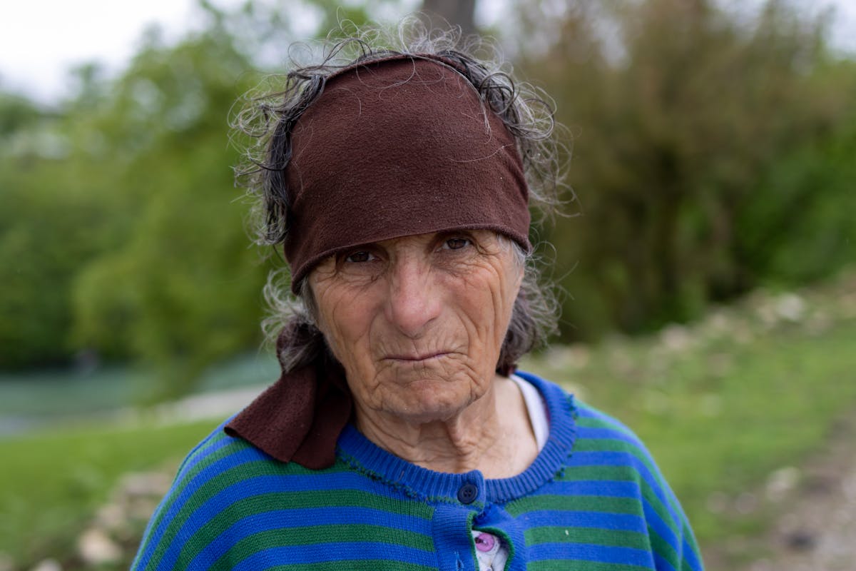 Cilt yaşlanma çizgileri